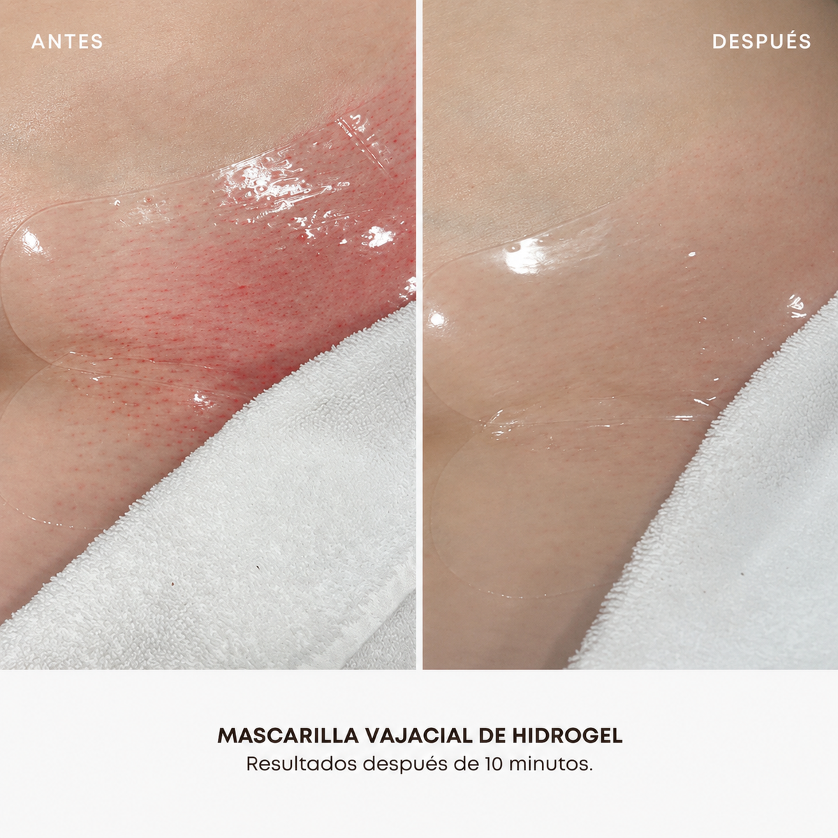 Kit x5 Mascarillas Vajaciales: hidrata y aclara tu zona del bikini.
