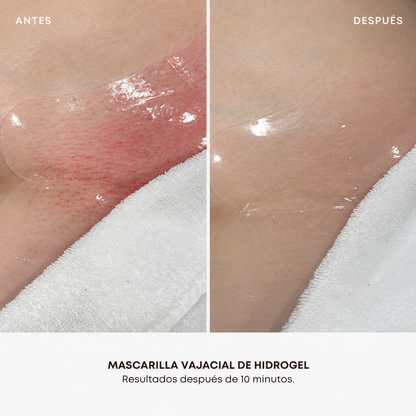 Kit x5 Mascarillas Vajaciales: hidrata y aclara tu zona del bikini.